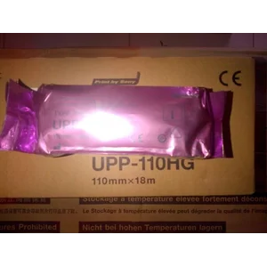 ALAT USG Scanner USG Kertas USG Sony UPP 110 HG 