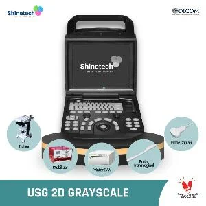 Alat USG 2 Dimensi With Probe Convex + Probe Transvaginal + Printer B/W + Trolley + Stabilizer