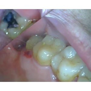  ALAT PENELITIAN GIGI - CARI MIKROSKOP DIGITAL USB DENTAL - CALL TOMAS  PT YAKIN MAJU SENTOSA DI SURABAYA