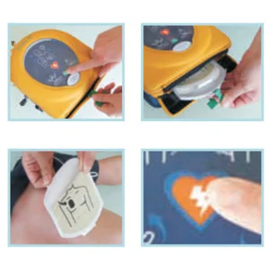 Aed Pad P 500 Defibrillator Dengan Penasihat Cpr - Available In Indonesian Language