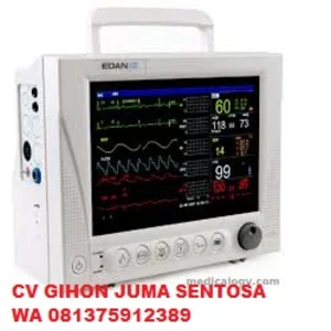 Patient Monitor Murah 